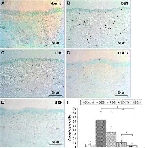 Figure 11 TUNEL staining of corneal sections from the different groups.Notes: (A) Normal group, (B) DES-treated group, (C) PBS-treated group, (D) EGCG-treated eyes, (E) GEH-treated eyes, and (F) number of apoptotic cells in the cornea (*P<0.05 compared with DES, #P<0.05 compared with GEH).Abbreviations: DES, dry-eye syndrome; EGCG, epigallocatechin gallate; GEH, gelatin–EGCG with hyaluronic acid coating.