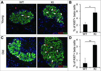 Figure 4. Overexpression of cyclin D2 enhances β cell replication in old KI mice. (A, B) Representative immunofluorescence staining (A) and quantification (B) for insulin (green), Ki67 (red), and DAPI (blue) in young (6-week-old) WT and KI mice challenged with a single dose of STZ (90 mg/kg). C, D. Representative immunofluorescence staining (C) and quantification (D) for insulin (green), Ki67 (red), and DAPI (blue) in old (8-month-old) WT and KI mice challenged with a single dose of STZ (90 mg/kg). White arrows indicate Ins+Ki67+ cells. Data shown as mean ± SD (n = 3–4 mice per group). *P < 0.05, **P < 0.01.