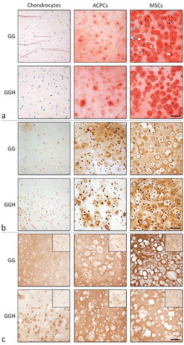 Figure 3 Histological assessment of cartilage-like tissue formation at day 28 in hydrogel constructs with the different cell types and formulations (N = 3, n = 3). Safranin-O/fast green staining (a). Collagen type II staining (b). Collagen type I staining with the day 1 appearance in the inserts (c). Scale bars represent 100 µm for all images. With GG = 10% gelMA + 0.5% gellan gum, and GGH = 9.5% gelMA + 0.5% gellan gum + 0.5% HAMA.