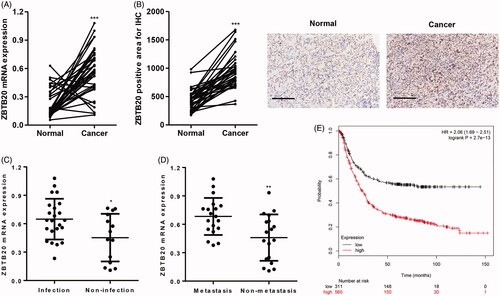 Figure 1. ZBTB20 expression in gastric cancer tissues. ZBTB20 expression levels in gastric cancer tissues (n = 37) and their adjacent normal gastric tissues (n = 37) were determined by real-time PCR (A) and immunohistochemistry (B). Scale bars: 100 μm. (C, D) ZBTB20 expression levels in gastric cancer patients with different status of H. pylori infection and metastasis were determined by real-time PCR. (E) Overall survival of gastric cancer patients from Kaplan Meier-plotter database. *p < .05, **p < .01, ***p < .001 compared with adjacent normal, infection, or metastasis group.