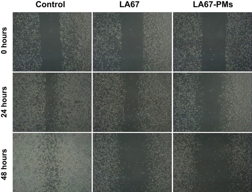 Figure 7 Influence of LA67-PMs on wound healing.Abbreviation: LA67-PMs, LA67-loaded polymeric micelles.