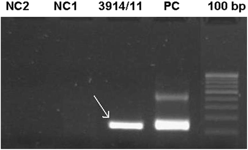 FIGURE 2  Gel photograph of positive nested PCR on aqueous sample for M.tb done against a positive (PC) and negative (NC) control.