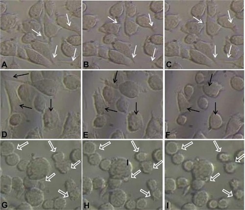 Figure 2 Inverse microscopic images of cells grown on Petri dishes taken at different time periods. A–I are images taken at 30, 30.5, 31, 55, 55.5, 56, 70, 70.5, and 71 hrs, respectively.Notes: White arrows showing examples of lamellipodium extension and contraction, black arrows indicate retraction of lamellipodium to form approximately round shape, and block arrows show some examples of blebbing activity of L929 cells.