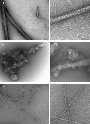 Figure 2 Electron micrographs of the different HET-s PFD amyloids.Notes: (A) Amyloids formed at pH 7 and 37°C in high ionic strength consist of ordered bundles containing a variable number of 5 nm fibrils. (B) Amyloids formed at pH 7 and 37°C at low ionic strength consist of disordered aggregates that contain loosely associated with 5 nm fibrils embedded in amorphous material. (C) Amyloids formed at pH 2 and 37°C consist of dispersed fibrils that are thicker than those formed at pH 7 and exhibit some polymorphism. The majority species are triplets of 5 nm single fibrils twisted around each other with a 45 nm axial repeat. More rarely, ribbon-like structures composed of three or more laterally associated single fibrils are seen (right panel). In each pair of panels (A–C), the left one is at low magnification and the right one at high magnification, according to the scale bars in (A) which represent 50 nm. Adapted from Journal of Molecular Biology, 370(4), Sabate R, Baxa U, Benkemoun L, et al, Prion and non-prion amyloids of the HET-s prion forming domain, 768–783, Copyright © 2007, with permission from Elsevier.Citation32Abbreviation: HET-s PFD, HET-s prion-forming domain.