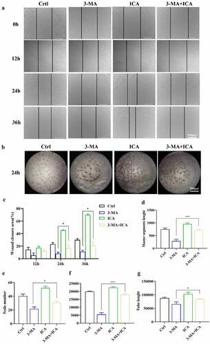 Figure 8. Autophagy inhibitor obstructed ICA-treated EA.hy926 migration and tube formation. EA.hy926 cells were treated by 10 μM and/or 3-MA, the cell migration was measured by (a)wound healing assays and (c)quantified. Angiogenetic ability was detected using (b)tube formation assays and (d) master segments length, (e)node number (f)meshed area and (g) tube length were quantified