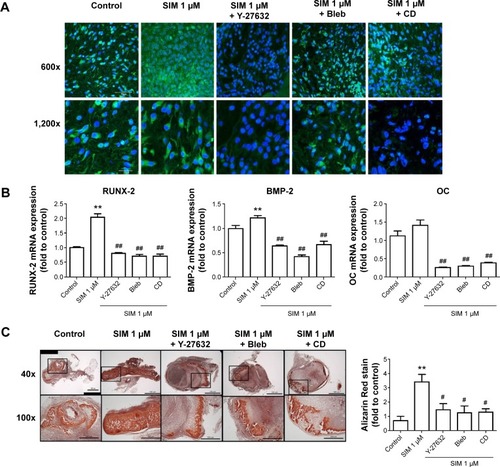 Figure 5 Simvastatin-induced osteogenic differentiation in an animal model of ectopic bone formation was reduced by cytoskeletal alteration agents.Notes: Immunofluorescence staining revealed that the F-actin, staining with phalloidin, was increased by simvastatin treatment and reduced by cotreatment with biochemical agents, scale bar represents 50 µm (A). Inhibiting actin filament organization or decreasing cell rigidity significantly inhibited simvastatin-induced osteogenic gene expression (B). Representative masses of ectopic bone formation were stained with Alizarin Red S, the 100× figures are represented as the boxed area in the 40× line, and the mineralization of masses was quantified using Image-Pro Plus software (C). The results are the mean values of three independent measurements, error bars: SEM. **P<0.01 vs control; #P<0.05; ##P<0.01 vs SIM (1 µM).Abbreviations: SIM, simvastatin; Bleb, blebbistatin; CD, cytochalasin D; SEM, standard error of the mean; OC, osteocalcin.