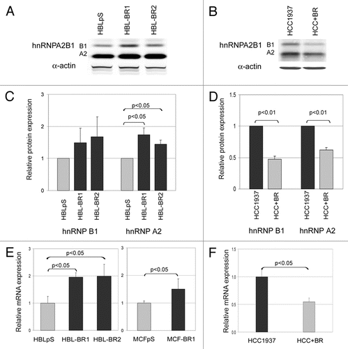 Figure 2 BRCA1-deficient cells express higher levels of hnRNPA2B1 than BRCA1-proficient cell lines. Representative hnRNPA2B1 western blot analysis on nuclear-enriched extracts obtained from HBLpS scramble vector transfected cells and BRCA1-silenced HBL100 cells (HBL-BR1, HBL-BR2) (A) and HCC1937 and the corresponding wtBRCA1 expressing cell line (HCC+BR) (B). Blots were probed with α-actin for normalization. (C) hnRNP A2 and B1 relative protein levels measured in the western blot analysis of nuclear-enriched extracts from HBLpS (grey histograms) and HBL-BR1 and HBL-BR2 (black histograms). Data illustrate the ratio of normalized hnRNP B1 and A2 sample signals to normalized control signal and represent the means of three independent experiments. Standard deviation (bars) and statistically significant differences are reported. (D) hnRNP A2 and B1 relative protein expression in HCC1937 (black histograms) and HCC+BR (grey histograms) calculated as in (C). Standard deviation (bars) and statistically significant differences are reported. (E) hnRNPA2B1 mRNA expression levels were analyzed by qRT-PCR in the BRCA1-expressing scramble vector transfected cell lines (HBLpS and MCFpS) (grey histograms) and in the BRCA1-silenced HBL100 and MCF7 cell lines (HBL-BR1, HBL-BR2 and MCF-BR1) (black histograms). Histograms represent the means of the relative mRNA expression levels (normalized to controls as described in material and methods) of three experiments. Standard deviation (bars) and statistically significant differences are reported. (F) Relative hnRNPA2B1 mRNA expression in HCC1937 and HCC+BR BRCA1-expressing cell lines (black and grey histograms, respectively), as assayed by qRT-PCR. Standard deviation (bars) and statistically significant differences are reported.