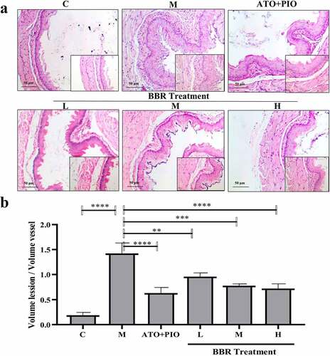 Figure 2. BBR reduced the plaque area in ApoE−/− mice carotid arteries. (a) H&E staining representative image of the carotid artery (large image was magnified 40; small image was magnified 200); (b) the ratio of carotid artery atherosclerotic plaque area to lumen area; the findings were presented as mean ± SD; ** P < 0.01, *** P < 0.001, **** P < 0.0001