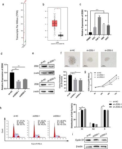 Figure 4. ZEB2 knockdown was associated with cell cycle arrest and cell proliferation in AML. Expression of ZEB2 in normal and AML samples from the database GEPIA (a and b). The expression of ZEB2 in KG1a, THP-1, NB4, U937 cells and PBMCs was assessed by RT-qPCR (c). Knockdown efficiency of sh-ZEB2-1 and sh-ZEB2-2 was verified by RT-qPCR and WB (d and e). Colony formation assays and CCK-8 assays were utilized to measure cell growth (f and g). WB and flow cytometry were conducted to assess cell cycle stage. (h and i). *p < 0.05, **p < 0.01, ***p < 0.001.