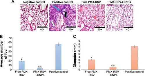 Figure 5 (A) Histopathological analysis of H&E-stained excised lung sections of mice treated with free PMX-RSV and ion-paired PMX-RSV-LCNPs (F10) in comparison to positive control and negative control groups. (B) Average number of foci in the excised lungs, (C) The diameter of lung foci (mm).Notes: #P<0.05 vs positive control, %P<0.05 vs Free PMX/RSV mixture.Abbreviations: LCNPs, liquid crystalline nanoparticles; PMX, pemetrexed; RSV, resveratrol.