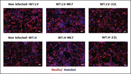 Figure 5. Immunofluorescence analysis of nestin marker in non-infected, ME7 or 22L infected proliferating cells derived from the hippocampus (H) or lateral ventricle (LV) of mice during proliferation conditions (red: nestin; blue: Hoechst nuclei coloration; scale bar, 5 μm).
