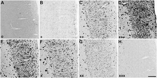 Figure 2. Representative photomicrographs of histochemical staining at pH 6.8 in human orbitofrontal cortex sections. The sections were from the same brain to illustrate staining patterns demonstrating the intensity of ChE staining of AD pathology using thioesters (A-D) and the reduction of staining intensity for BChE at pH 6.8 by ester compounds (E-H). Thioester staining intensity, summarised in Table 2, was categorised as (A) o (no staining), (B) + (weak), (C) ++ (moderate), or (D) +++ (strong). The reduction in staining by esters, also summarised in Table 2, was categorised as (E) – (no inhibition), (F) x (slight), (G) xx (moderate) or (H) xxx (strong). Scale bar = 400 µm.