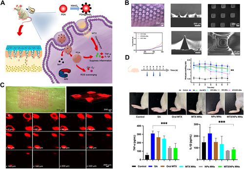 Figure 7 (A) Schematic Illustration of the Synthesis of a High-Performance Nanozyme of PDA@MnO2 and the Fabricated Microneedles Successfully Delivered Drugs with Nanocomposites, As Shown by Results in Paw Swelling, MRI Image, and the Level of Cytokines. (B) Characteristics of MNs (C) Skin Penetration in vitro and in vivo. (D) Therapeutic Effects of MNs. (**p<0.01,***p<0.001). Reprinted in part with permission from Wu C, Cheng J, Li W, Yang L, Dong H, Zhang X. Programmable polymeric microneedles for combined chemotherapy and antioxidative treatment of rheumatoid arthritis. ACS Appl Mater Interfaces. 2021;13(46):55559–55568.Citation96 Copyright 2020 American Chemical Society.