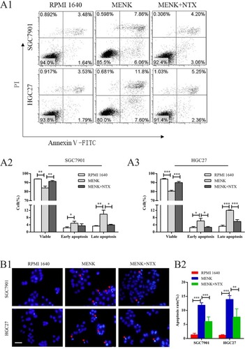 Figure 4 Effect of MENK on apoptosis and apoptotic morphology of SGC7901 and HGC27 cells in vitro.Notes: (A1, A2, A3) Apoptosis was measured by flow cytometry using an Annexin V-FITC/PI kit. The percentage of early apoptotic cells (AV+/PI–, P<0.05) and late apoptotic cells (AV+/PI+, P<0.01) in the MENK-treated group increased significantly vs those in the control group. Also, the percentage of viable cells decreased accordingly (AV–/PI–, P<0.01). The percentage of early apoptotic cells (AV+/PI–, P<0.05) of HGC27 cells and the percentage of late apoptotic cells (AV+/PI–, P<0.05) of both cell lines in the MENK+NTX group decreased significantly vs those in the MENK-treated group. Similarly, the percentage of viable cells increased accordingly (AV–/PI–, P<0.01). (B1, B2) Fluorescence micrographs of SGC7901 and HGC27 cells stained with Hoechst 33258 (100×). The cells treated with 5 mg/mL MENK and 5 mg/mL MENK combined 200 nM NTX for 48 hours showed that MENK induced apoptosis in SGC7901 cells, characterized by nuclear condensation or nuclear fragmentation. In all graphs, data are represented as mean±SD of more than three independent experiments (*P<0.05, **P<0.01, ***P<0.001).Abbreviations: FITC, fluorescein isothiocyanate; MENK, methionine enkephalin; NTX, naltrexone; PI, propidium iodide.