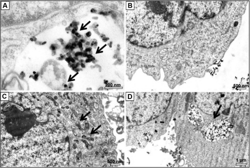 Figure 2 Distribution of titanium oxide nanoparticles (TiO2NPs) in hFOB 1.19 cells.Notes: (A) Arrows indicate TiO2NP (50 μg/mL) uptake by cells following 24 hours’ incubation. (B) A representative image of the osteoblasts showing normal cell ultrastructure after incubation with nanoparticles (NPs) at 50 μg/mL for 24 hours. (C) Altered mitochondrial morphology after 48 hours’ exposure to TiO2NPs (50 μg/mL). Arrows indicate mitochondrial profiles with condensed matrix. (D) Ultrastructural evidence of the presence of NPs within the cell after 24 hours’ exposure to TiO2NPs. Note aggregates of TiO2NPs inside the cell vacuoles. Arrow indicates internalization of nanoparticles.