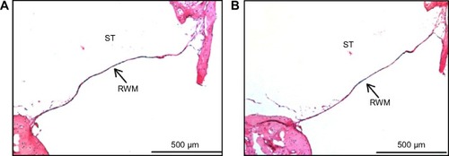 Figure 9 Hematoxylin and eosin-stained histological sections of a decalcified guinea pig middle-ear sample.Notes: (A) RWM of the control ear with saline application. (B) RWM 1 day after the DEX-NPs administration. Blood is also visible in the scala tympani (n=3).Abbreviations: RWM, round window membrane; ST, scala tympani; DEX-NPs, dexamethasone-loaded polyethylene glycol-coated polylactic acid stealth nanoparticles; n, number.