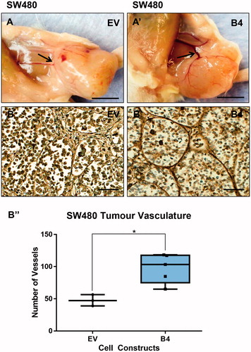 Figure 8. Evaluation of SW480 tumor vascularization. (A–A’) SW480 tumor vasculature at the time of harvesting (Scale bar = 2 mm). (B–B’) SW480 immunohistochemical labeling of vasculature with anti-Von Willibrand Factor in subcutaneous tumors (Scale bar = 100µm). (B’’) Quantification of vessel numbers using stereological point count method (N = 3 EV tumors, N = 5 B4 tumors). *p < .05.