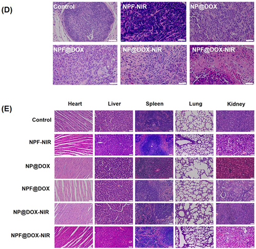 Figure 7 In vivo antitumor efficacy of NPF@DOX in BALB/c mice and biosafety analysis. (A) Representative images of tumor-bearing mice taken 12 d post-treatment. The arrows in the images points to the location of the tumor. (B) Tumor volume growth after various treatments. Data are presented as means ± SD, n=3 (***P<0.001) (C) Body weight comparisons of mice following intravenous administration of different treatments in tumor-bearing BALB/c nude mice (mean ± SD) with 3 mice in each group. (D) H&E staining images of excised tumors at the end of treatment. Scale bar: 50 µm. (E) H&E staining images of hearts, livers, spleens, lungs, and kidneys of mice in each group after tail vein injection of nanocarriers. Scale bar: 50 μm.