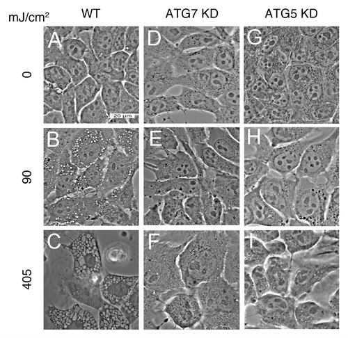 Figure 4. WST11 induced vacuolization. Cultures of wild-type (A–C), ATG7 KD (D–F) and ATG5 KD (G–I) 1c1c7 cells were incubated with 1 μM WST11 for 16 h prior to irradiation with light doses of 0 (A–G), 90 mJ/cm2 (B,E and H), or 405 mJ/cm2 (C, F and I). Images were captured 2 h after irradiation. Bar in (A): 20 μm. Images are representative of three independent experiments.