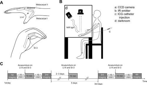 Figure 1 Study protocol for acupuncture and ICG perfusion imaging.