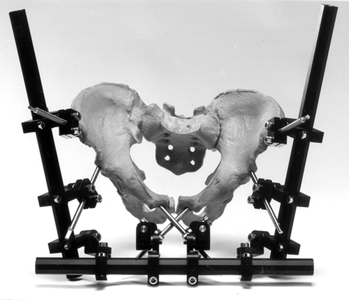 Figure 4. The Orthofix experimental external fixator with parasymphyseal pins connected to it. (The replica of a pelvis shown here is not the perspex model described in the text).