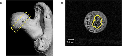 Figure 1. Micro-CT images of trabecular bone of a proximal femur.The region of interest (ROI) was set as starting from 60 μm distal to a proximal growth plate, including a 750 μm and spongy bone for analyses. (a) overall outline (yellow dotted contour), (b) cross section of ROI (transverse, as yellow contour).