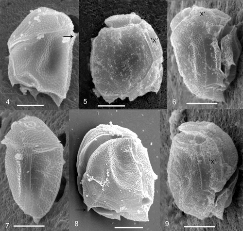 Figs 4 – 9. Cabra matta, gen. nov., sp. nov., SEM images. Fig. 4. Left lateral view, arrow points to dorsally pointed bump. Fig. 5. Right lateral view. Fig. 6. Ventral view. Fig. 7. Dorsal/left lateral view. Fig. 8. Posterior/left lateral view showing cingular plates. Arrow points to posteriorly pointed flange. Fig. 9. Ventral/right lateral view showing ‘x’ plate. The ‘x’ plate is indicated for orientation purposes. All scale bars represent 10 μm.