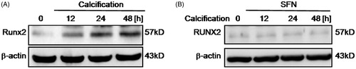 Figure 4. Calcification induced Runx-2 expression then SFN decreased Runx-2 expression following calcification. (A) Runx2 expression was detected by Western blotting following calcification. (B) Runx2 expression was detected by Western blotting following 5 μM SFN pretreatment and calcification.