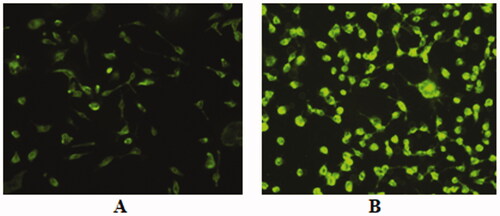 Figure 6. Fluorescence microscopic images of SKOV-3 human ovarian cancer cells after incubation of 4 h with coumarin-6 loaded PLGA-PEG nanoparticles (A) and PLGA-PEG-FA nanoparticles (B). The image B show higher uptake of the PLGA-PEG-FA nanoparticles in the cells.