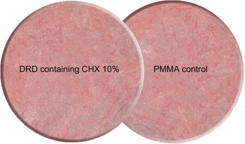 Figure 1 Discs of the two specimen groups showing the drug release device (DRD) impregnated with chlorhexidine (CHX) 10% and the control poly (methyl methacrylate) (PMMA) disc.