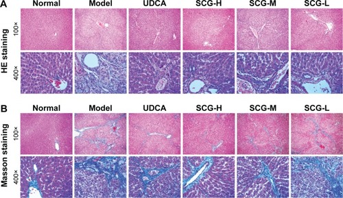 Figure 6 The effect of SCG on the pathological features of liver tissues of experimental rats stained with HE (A) and Masson (B). (SCG-H: TAA + SCG [3.6 g/kg]; SCG-M: TAA + SCG [1.8 g/kg]; SCG-L: TAA + SCG [0.9 g/kg]).