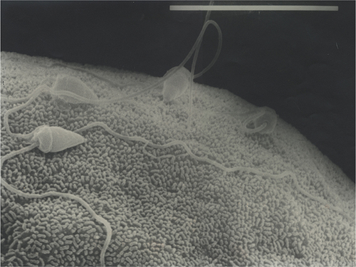 Figure 1 Spermatozoa on the surface of a sea urchin oocyte.
