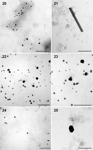 Figs 20–25. TEM microphotographs of gold nanoparticles of different shapes synthesized by Phormidium valderianum biomass. 20. Spherical particles at pH 5. 21. Nanorod at pH 5. 22. Spherical and triangular particles synthesized at pH 7. 23. Enlargement of a triangular particle. 24. Spherical and hexagonal particles produced at pH 9. 25. Enlargement of a hexagonal nanoparticle. Scale bars: 200 nm (Figs 20, 21, 24), 100 nm (Figs 22, 23) and 50 nm (Fig. 25).