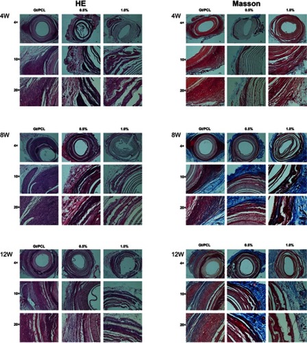 Figure 6 Histological images of scaffold constructs with H&E and Masson’s staining at 4, 8 and 12 weeks in vivo. No obvious cell necrosis or damage was detected in rats 4, 8, or 12 weeks after implantation. Scale bars: 100 µm. 0.5% and 1.0% means different mass fractions of disordered Gt/PCL membranes loaded with graphene.Abbreviations: H&E, hematoxylin and eosin; Gt/PCL, gelatin/polycaprolactone.