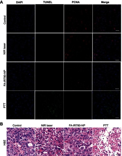 Figure 11 Pathological effects of the different treatments. (A) PCNA and TUNEL staining of tumor regions after the different treatments. (B) H&E staining of tumor regions after the different treatments. The white and black bars represent 200 μm, n=3 per group.