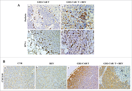 Figure 4. Perforin, IFN-γ and CXCL10 expression in tumors developed in Scid/Beige mice orthotopically engrafted with HTLA-230 NB cells and treated with GD2-CAR T cells alone or combined with BEV. A.Perforin and IFN-γ immunostaining of tumor masses from mice receiving GD2-CAR T cells either alone (a,b) or in combination with BEV (c,d). (a, b:X400; c, d: X630). B.CXCL10 immunostaining of tumors from untreated mice (a, CTR) and from mice treated with BEV (b), GD2-CAR T cells alone (c) or in combination with BEV (d). (c, white arrows indicate CXCL10+ cancer cells at the edge; d, N: necrosis) (a-d:X400).