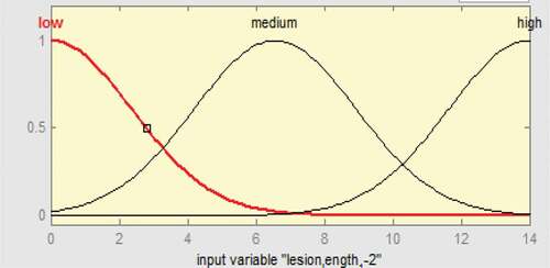 Figure 6. Membership functions of 1 mm ≤ ulcer length ≤ 2 mm