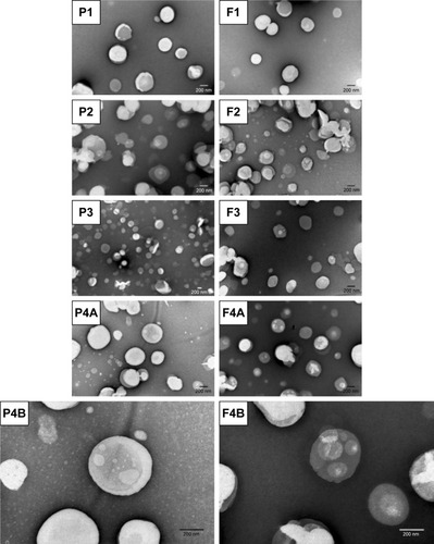 Figure 2 TEM images of the AMX-loaded LNPs and the corresponding unloaded LNPs.Notes: P1, F1, P2, F2, F3, P4A, and F4A are at a magnification of 50,000×. P3 is at a magnification of 25,000×. P4B and F4B are at a magnification of 100,000×.Abbreviations: AMX, amoxicillin; LNPs, lipid nanoparticles; TEM, transmission electron microscopy.