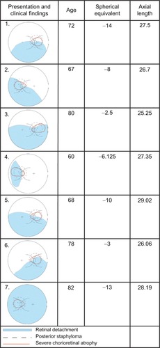 Figure 1 Fundus diagrams of retinal detachments at presentation and ocular parameters.