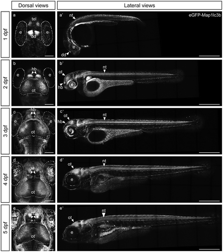 Figure 1. eGFP-Map1lc3b in Tg(elavl3:eGFP:map1lc3b)la50016± is expressed throughout the nervous system. (a-e) Dorsal views of representative confocal images of Tg(elavl3:eGFP:map1lc3b)la50016± embryos/larvae at indicated developmental stages. Some autofluorescence from the skin is visible in (c-e). Scale bars: 100 μm. (a’-e’) Lateral views of representative reconstructed confocal tile-scan images of Tg(elavl3:eGFP:map1lc3b)la50016± embryos/larvae at the indicated developmental stages. Dotted lines outline the indicated structures. dd, dorsal diencephalon; e, eye; hb, habenula; nt, neural tube; ot, optic tectum; tel, telencephalon. Scale bars: 500 μm.