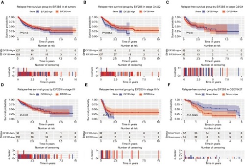 Figure 4 Survival analysis of EIF2B5 expression in terms of relapse-free survival.Notes: Kaplan–Meier curves produced survival analysis (A) and subgroup analysis of histological grade (G1/G2 and G3/G4; B and C) and clinical stage (I/II and III/IV; D and E). Validation group of survival analysis in GSE76427 (F).