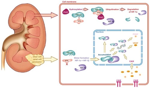 Figure 2 The Von Hippel–Lindau/hypoxia-inducible factor oxygen-sensing pathway and its relevance in clear-cell renal cell carcinoma.
