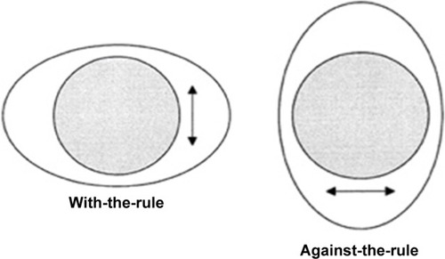 Figure 1 How with-the-rule and against-the-rule create an oval-shaped central cornea.