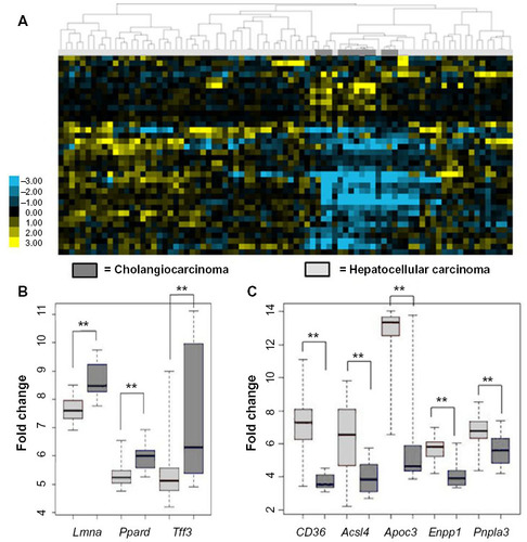 Figure 3 Human HCC and CC gene expression datasets show different regulation of genes related to fatty liver.