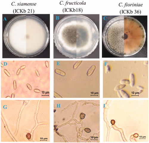 Figure 4. Morphological characteristics of present isolates belonging to different Colletotrichum species. (A–C) A 7-day-old colony on PDA; (D–F) Conidia. G-I. Appressoria.