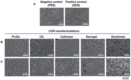 Figure 5 Morphological variation of red blood cells incubated with curcumin nanoformulations for 2 hours. Phase contrast images of red blood cells incubated with (A) controls (phosphate-buffered solution and sodium dodecyl sulfate), (B) curcumin nanoformulations (50 μM), and (C) curcumin nanoformulations (100 μM). Bar equals 20 microns.