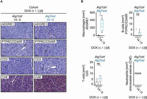 Figure 4. Macrophages accumulate in the pancreas of induced Atg7-shRNA mice. (A) Representative pancreatic tissue stained as indicated to highlight macrophages (ADGRE1/F4/80) and lymphocytes: B-cells (PTPRC; isoform CD45R/B220), T-cells (CD3). Arrows point toward lymphocytes. The chloracetate esterase reaction (CAE) did not detect any neutrophils. Scale bars: 20 µm. (B) Quantification of the inflammatory infiltrate. Statistics: Welch’s t-test (n from left to right: 6, 6 (macrophages), 6, 6 (B-cells) and 5, 6 (T-cells)). *P < 0.05.