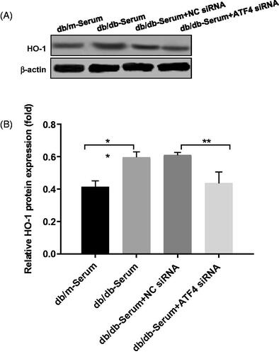 Figure 4. Effects of ATF4 knockdown on HO-1 expression on podocytes exposed to serum from DN mice. (A) Protein expression analysis revealed that HO-1 expression was increased by serum from DN mice, indicating increased ER stress, while ATF4 siRNA significantly reduced HO-1 expression in MCP-5 podocyte. (B) Densitometric analysis of protein expression from Figure 4(A) (**p < 0.01, *p < 0.05).