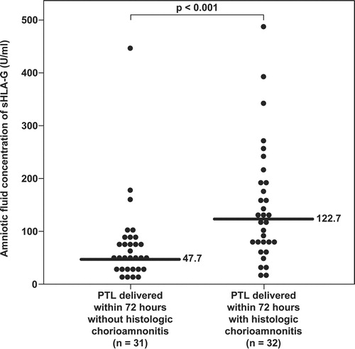 Figure 5.  Amniotic fluid concentration of sHLA-G in patients with spontaneous preterm labor with and without histologic chorioamnionitis who delivered within 72 h from amniocentesis. Patients with histologic chorioamnionitis and/or funisitis had a significantly higher median sHLA-G concentration in amniotic fluid than those without histologic inflammation (122.7 U/ml, IQR 79–190.1 vs. 47.7 U/ml, IQR 28.3–83.7, respectively; p < 0.001).