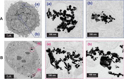 Figure 7 Cellular internalization of AuNPs into representative prostate cancer cell lines. TEM images of (A) PC-3 cell and (B) LNCaP cell treated with AuNPs-WCS-GA-DBBN (50 μg/mL) at 6 h and close-up morphologies of AuNPs in cell at (a) and (b) positions.